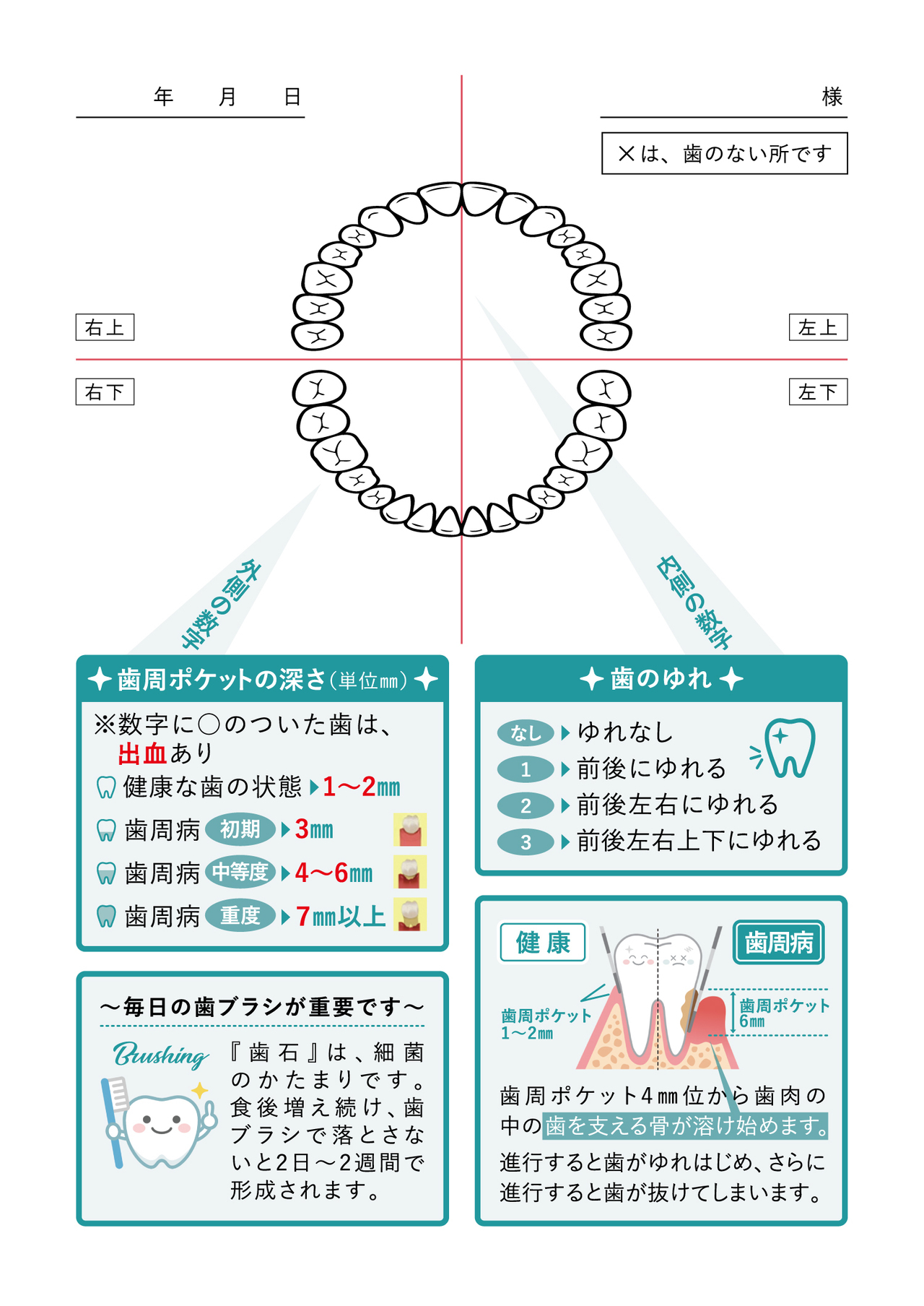 群馬県前橋市の歯科医院：あおなし歯科クリニックで歯周病治療