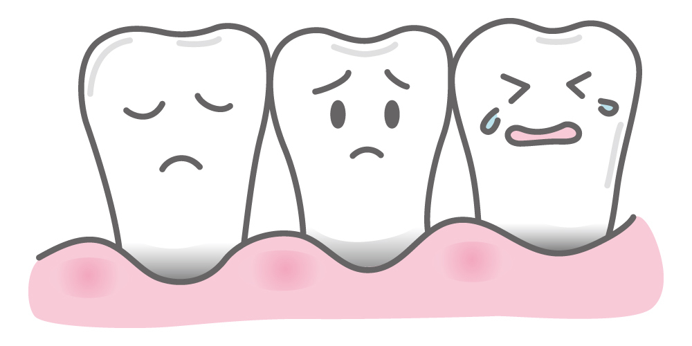 前橋市の歯医者のあおなし歯科クリニックが紹介する歯の豆知識情報です。